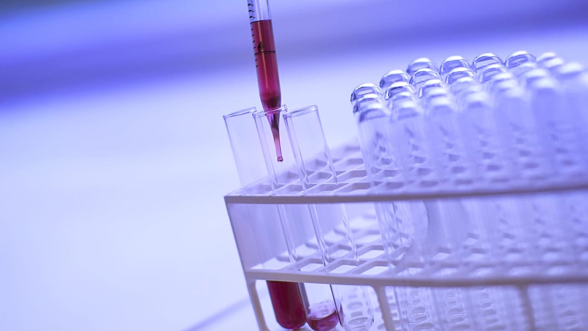 El País Vasco consigue reducir un 50% las muertes por cáncer de colon – Euronews.com