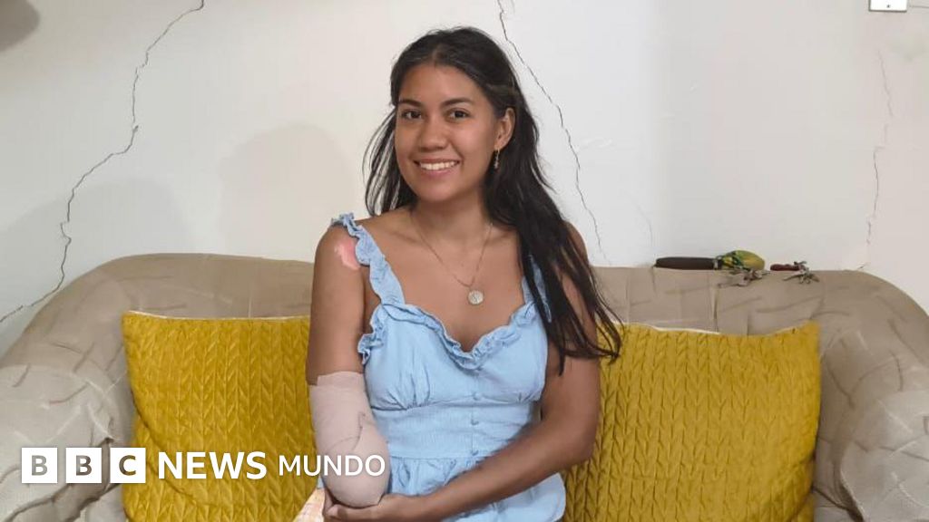 «Haber perdido a mi esposo me duele más que haber perdido mi mano derecha»: el testimonio de Nayarit Colmenares, la mujer amputada tras los terremotos en Venezuela